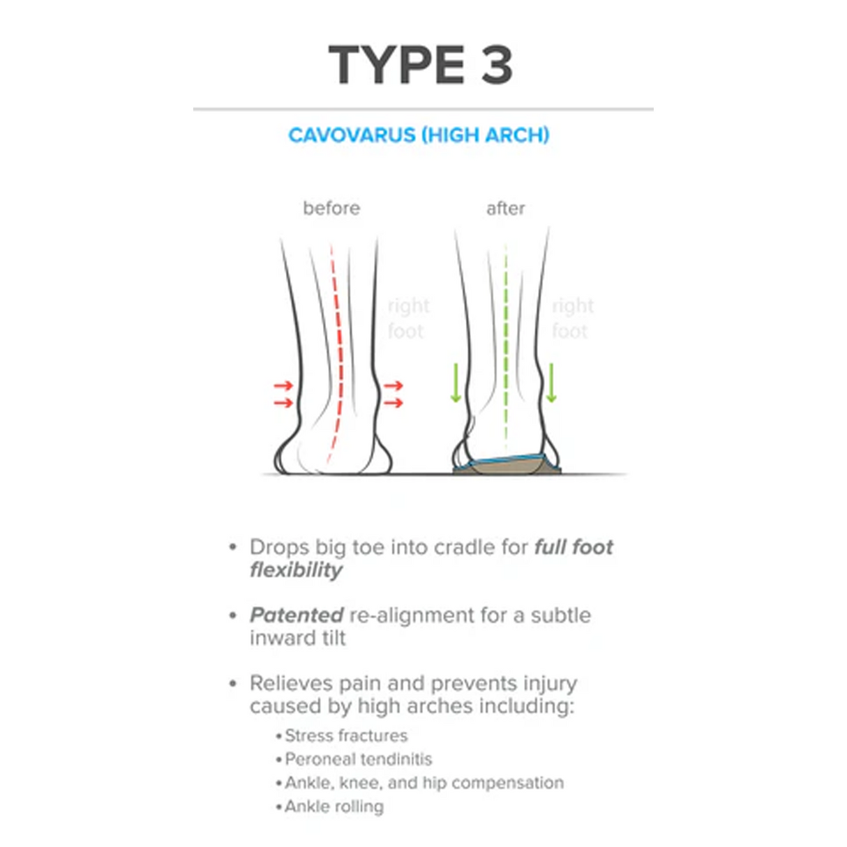Foot Scientific Arches Type 3 Supination/High Arch Orthotic (Unisex) Accessories - Orthotics/Insoles - Full Length - The Heel Shoe Fitters
